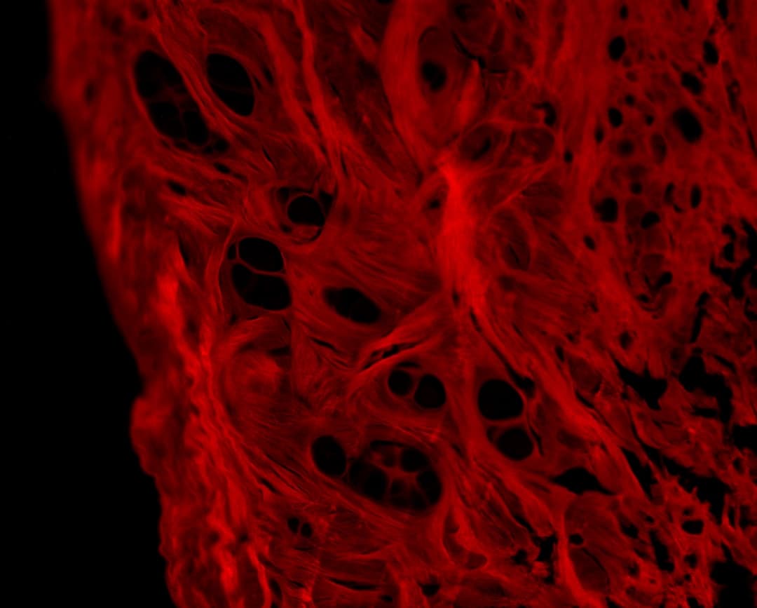 Why Does Chronic Inflammation Cause So Much Disease? — a close up of a red substance on a black background
